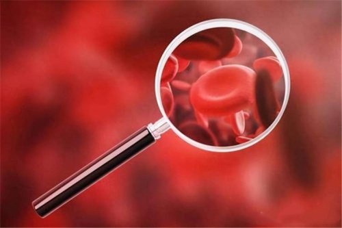 Cur Folate defectus Causae Anemia?