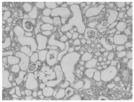 Series Introductio ad Impuritates Folatis Active: Detegendo Impact 5-Methyltetrahydropteroici acidum.